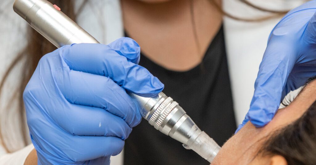 At Least 3 Women Infected With Hiv After 'vampire Facial'