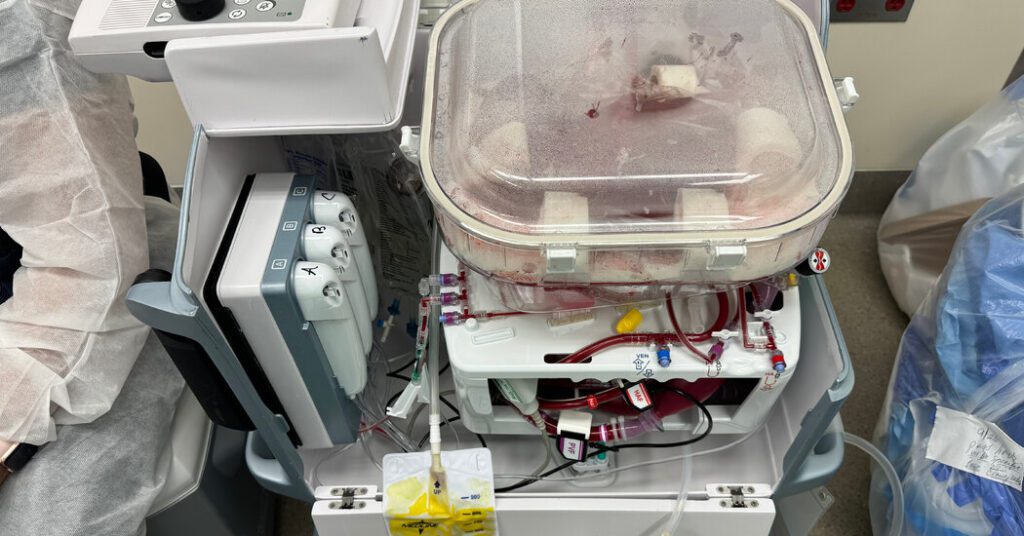 Technology To Reconstruct Organ Transplants
