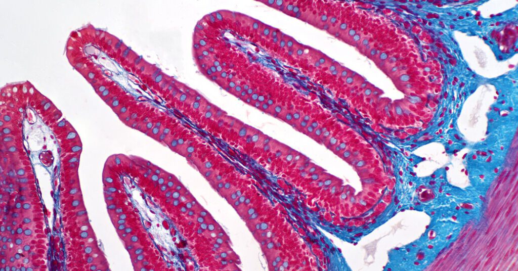 Young Adults Are Missing Early Warning Signs Of Colon Cancer