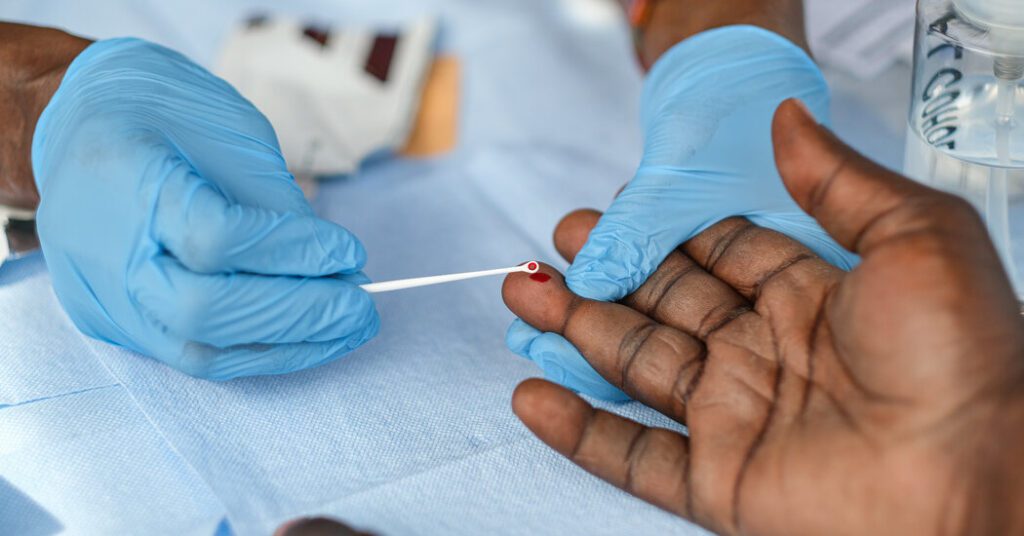 The trump administration is considering reducing hiv efforts at the