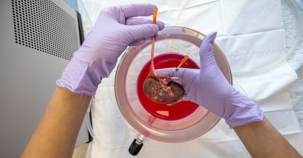 This kidney was frozen for 10 days. Can a surgeon implant it? This kidney was frozen for 10 days. can a surgeon